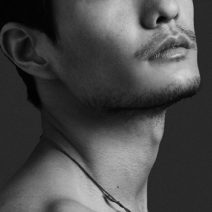 Thyroid Cartilage Shave