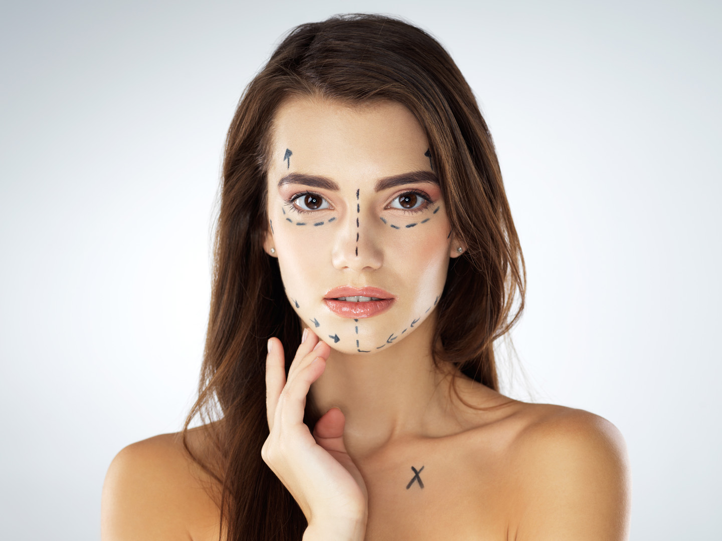 Woman with marks on her face getting ready for a surgical facelift